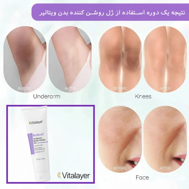 ژل روشن کننده نواحی حساس بادی ویت ویتالیر حجم 150 میلی لیتر